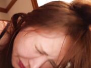 下班后无麻醉肛门扩张3